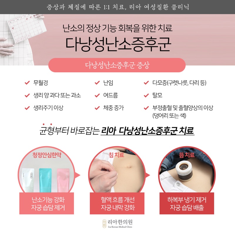 다낭성난소증후군 상담을 위한 생리와 생활 기록