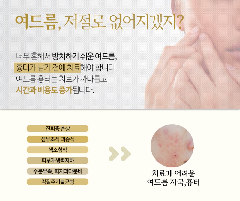 여드름 흉터가 남기 전 치료 필요성을 설명하는 리아한의원 안내 이미지