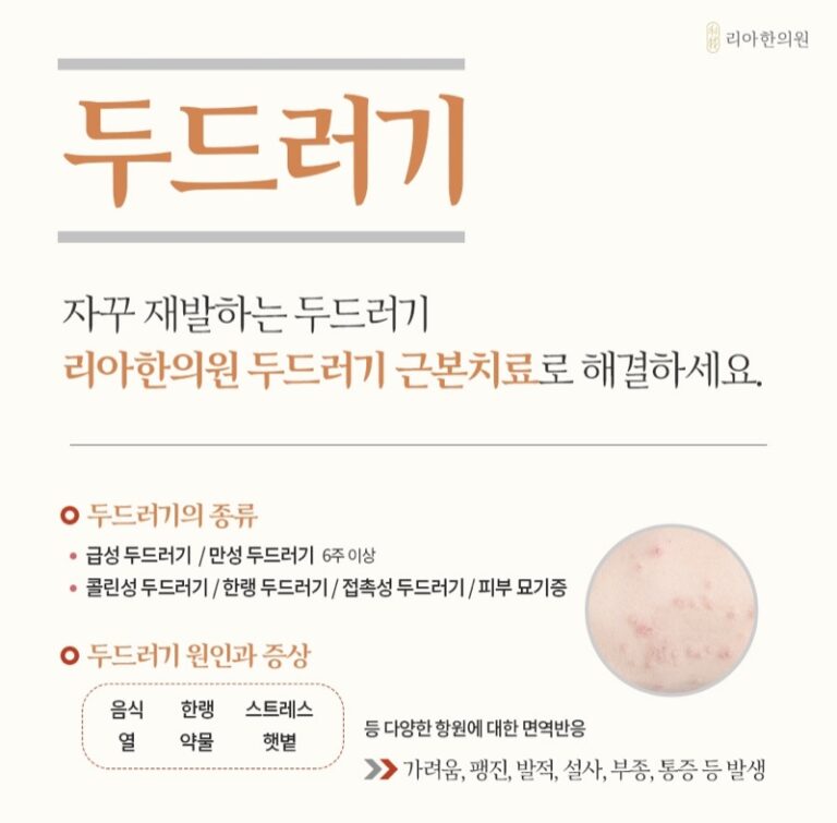 급성·만성 및 유발성 두드러기 유형과 증상을 설명하는 리아한의원 안내 이미지