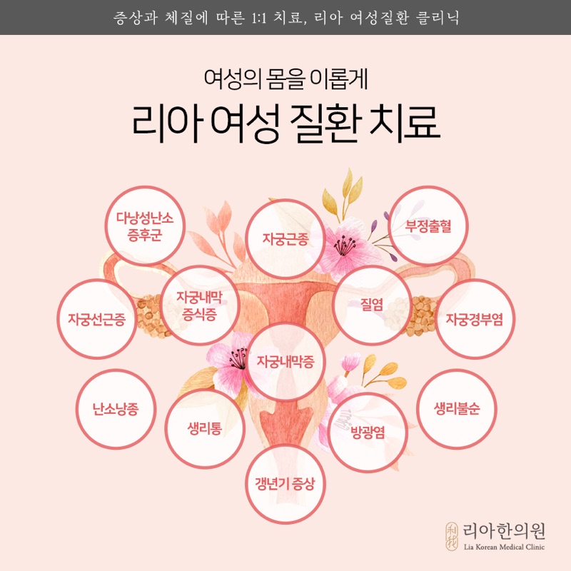 질염을 포함한 여성질환 상담 항목 안내